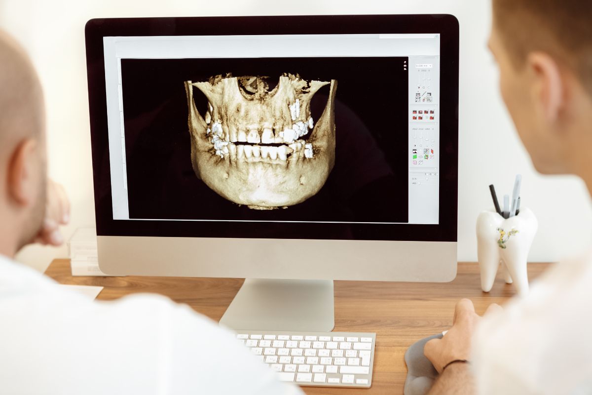 치과 의사가 환자의 구강 X-ray(파노라마) 영상을 보며 설명하는 장면