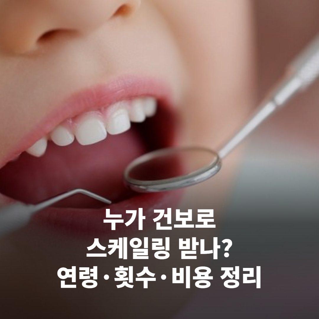 스케일링 건강보험 적용 대상, 누가·언제·얼마인지 한눈에